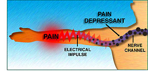 They also act to impede electrical conductivity of the nerve channels